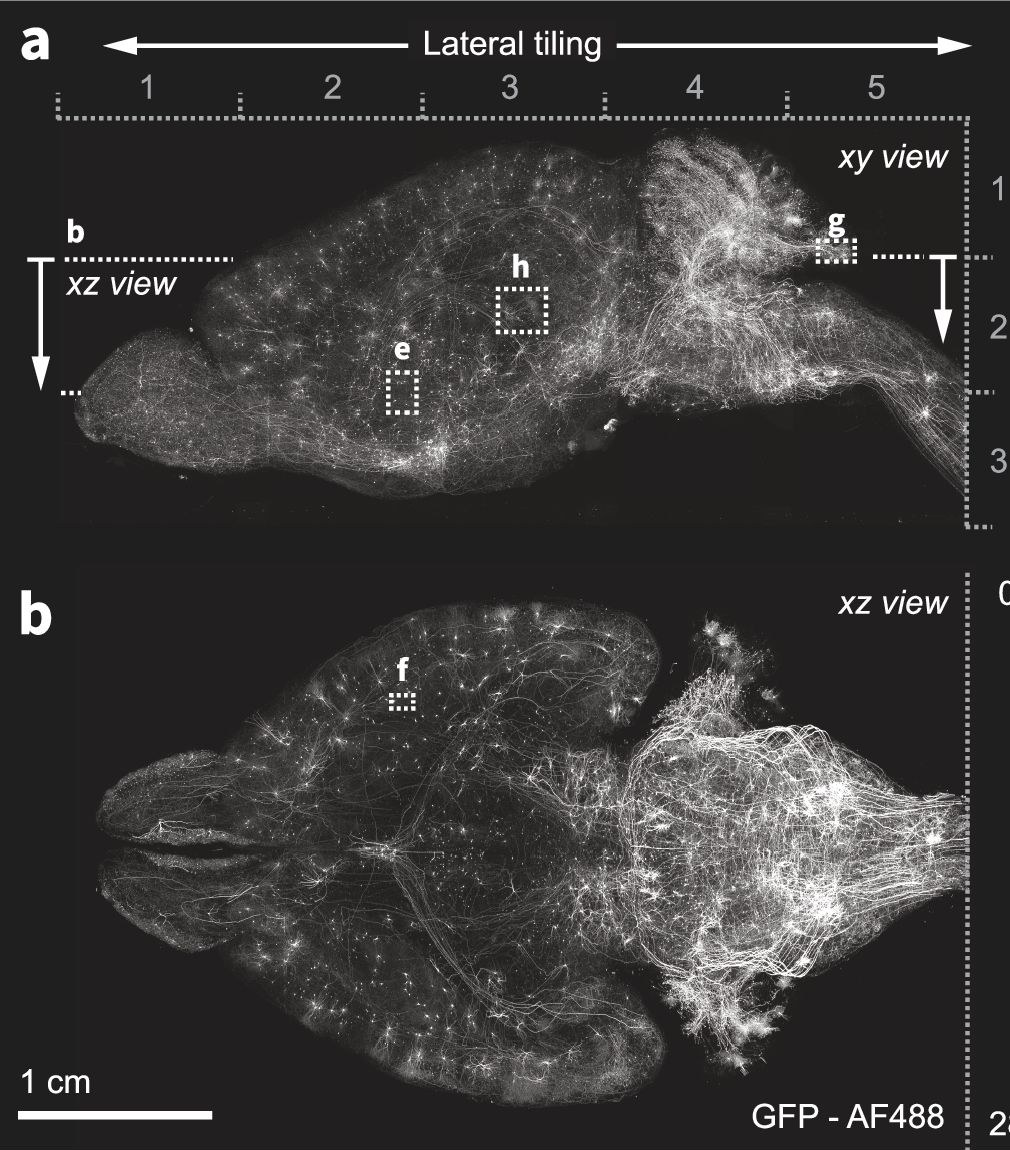 Two views of a whole expanded mouse brain with labeled axons visible throughout