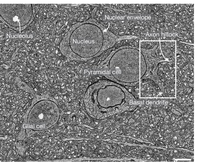 Light-microscopy image of expanded mouse cortex showing a pyramidal cell, nucleus, mitochondria and axons